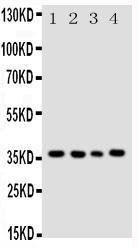 Anti-Bub3 Rabbit Polyclonal Antibody