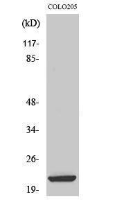 Western blot analysis of various cells using Anti-ML-IAP Antibody