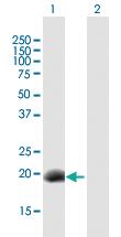 Anti-DPPA3 Mouse Polyclonal Antibody