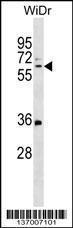 Anti-MMRN1 Rabbit Polyclonal Antibody (PE (Phycoerythrin))