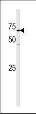 Anti-GAK Rabbit Polyclonal Antibody (AP (Alkaline Phosphatase))