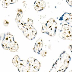 Immunohistochemistry analysis of paraffin-embedded human placenta using Anti-QKI Antibody [ARC2500] (A8374) at a dilution of 1:1,000 (40x lens). Perform microwave antigen retrieval with 10 mM citrate buffer pH 6.0 before commencing with IHC staining protocol.