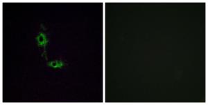 Immunofluorescence analysis of HeLa cells using Anti-GluR1 Antibody. The right hand panel represents a negative control, where the Antibody was pre-incubated with the immunising peptide