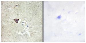 Anti-Cadherin 9 Rabbit Polyclonal Antibody