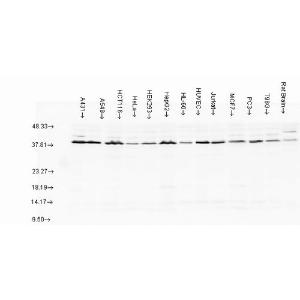 Western blot analysis of multiple Cell line lysates showing detection of AHA1 protein using Anti-AHA1 Antibody (A304995) at 1:1,000 for 2 hours at room temperature Load: 15  µgprotein Block: 15% BSA for 30 minutes at room temperature