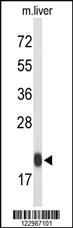 Anti-GPX1 Rabbit Polyclonal Antibody