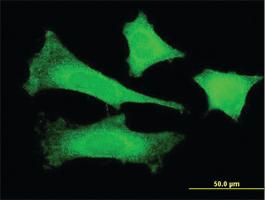 Anti-FBXO4 Mouse Monoclonal Antibody [clone: 2F2]