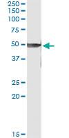 Anti-PRKX Antibody Pair