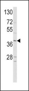 Anti-NEUROD1 Rabbit Polyclonal Antibody (PE (Phycoerythrin))