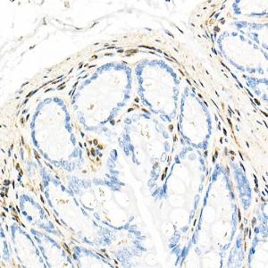 Immunohistochemistry analysis of paraffin-embedded mouse colon using Anti-QKI Antibody [ARC2500] (A8374) at a dilution of 1:1,000 (40x lens). Perform microwave antigen retrieval with 10 mM citrate buffer pH 6.0 before commencing with IHC staining protocol.