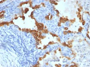 Anti-Cytokeratin 8 and 18 antibody