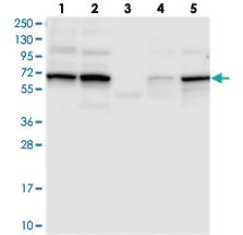 Anti-TCHP Rabbit Polyclonal Antibody