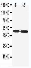 Anti-5HT1A Receptor Rabbit Polyclonal Antibody