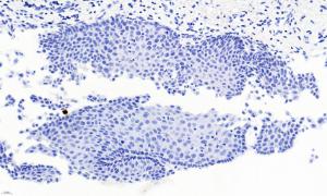 Anti-PAX3 Antibody (A83151) Negative Control showing staining of paraffin embedded Human Esophagus, with no primary antibody