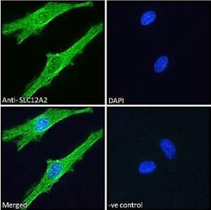 Anti-SLC12A2 Antibody (A84750) - Immunofluorescence analysis of paraformaldehyde fixed HeLa cells, permeabilized with 0.15% Triton. Primary incubation 1hr (10µg/ml) followed by Alexa Fluor 488 secondary antibody (2µg/ml), showing cytoplasmic/vesicle and membrane staining.