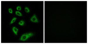 Immunofluorescence analysis of HUVEC cells using Anti-Cytochrome P450 2W1 Antibody. The right hand panel represents a negative control, where the antibody was pre-incubated with the immunising peptide.