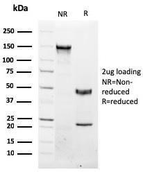 Anti-NKX3.1 antibody