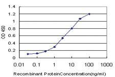 Anti-SMG1 Mouse Monoclonal Antibody [clone: 1C12]