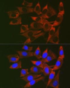 Immunofluorescence analysis of NIH/3T3 cells using Anti-RPL19 Antibody (A307804) at a dilution of 1:200 (40X lens). DAPI was used to stain the cell nuclei (blue)