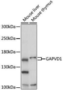 Anti-GAPex 5 antibody