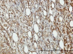 Anti-EIF5 Mouse Monoclonal Antibody [clone: 2E6-4C12]