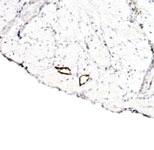 Anti-LYVE1 Rabbit Polyclonal Antibody