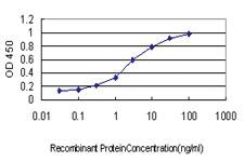 Anti-TRAPPC4 Mouse Monoclonal Antibody [clone: 2D10]