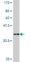 Anti-CNOT2 Mouse Polyclonal Antibody