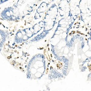 Immunohistochemistry analysis of paraffin-embedded rat colon using Anti-QKI Antibody [ARC2500] (A8374) at a dilution of 1:1,000 (40x lens). Perform microwave antigen retrieval with 10 mM citrate buffer pH 6.0 before commencing with IHC staining protocol.