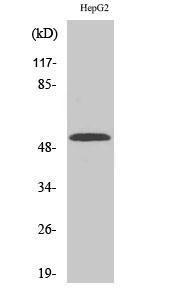 Western blot analysis of various cells using Anti-Cytochrome P450 2W1 Antibody