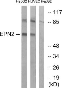 Antibody anti-EPN2 100 µg