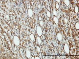 Anti-EIF5 Mouse Monoclonal Antibody [clone: 2E6-4C12]