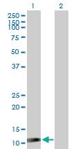 Anti-ISG15 Rabbit Polyclonal Antibody