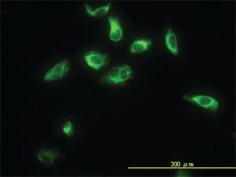 Anti-TPMT Mouse Monoclonal Antibody [clone: 1B5]