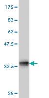 Anti-TCOF1 Mouse Monoclonal Antibody [clone: 8H3]