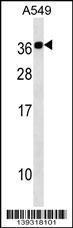 Anti-CABP2 Rabbit Polyclonal Antibody (APC (Allophycocyanin))