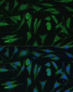 Anti-GAPex 5 antibody