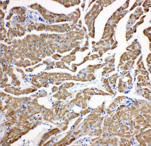 Anti-cardiac Troponin C Rabbit Polyclonal Antibody