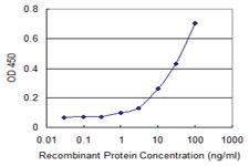 Anti-APOL6 Mouse Monoclonal Antibody [clone: 1F7]