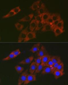 Immunofluorescence analysis of PC-12 cells using Anti-RPL19 Antibody (A307804) at a dilution of 1:200 (40X lens). DAPI was used to stain the cell nuclei (blue)