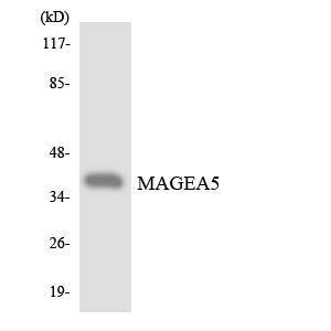 Western blot analysis of the lysates from K562 cells using Anti-MAGEA5 Antibody