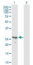 Anti-BPHL Mouse Polyclonal Antibody