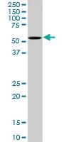 Anti-OXSR1 Mouse Monoclonal Antibody [clone: 3A8]