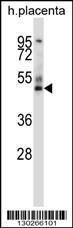 Anti-GRAMD3 Rabbit Polyclonal Antibody (AP (Alkaline Phosphatase))