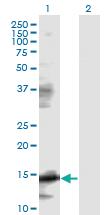 Anti-EIF5A Mouse Monoclonal Antibody [clone: 8C1]