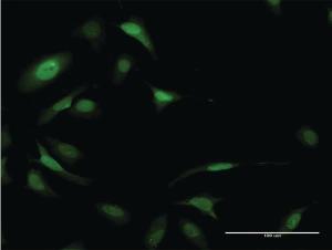 Anti-EIF5A Mouse Monoclonal Antibody [clone: 8C1]