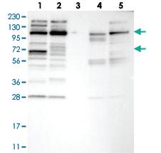 Anti-CHD1L Rabbit Polyclonal Antibody