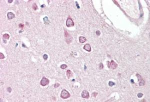 Anti-HAP1 Antibody (A83153) (375 µg/ml) staining of paraffin embedded Human Cortex Steamed antigen retrieval with citrate buffer pH 6, AP-staining