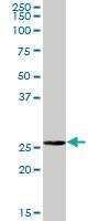 Anti-BPHL Mouse Polyclonal Antibody