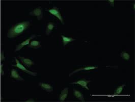 Anti-EIF5A Mouse Monoclonal Antibody [clone: 8C1]